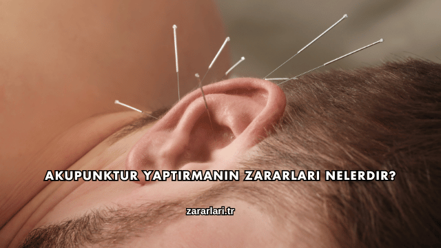 Akupunktur Yaptırmanın Zararları Nelerdir?