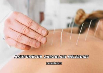 Akupunktur Zararları Nelerdir?