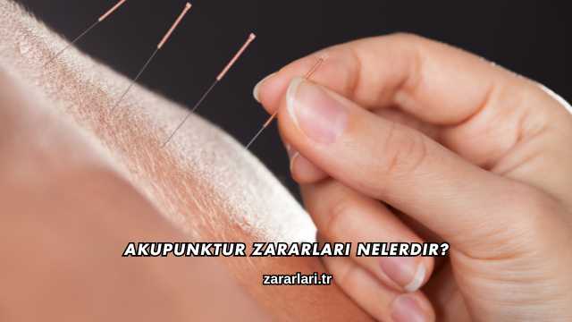 Akupunktur Zararları Nelerdir?