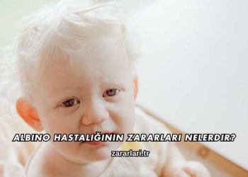 Albino Hastalığının Zararları Nelerdir?