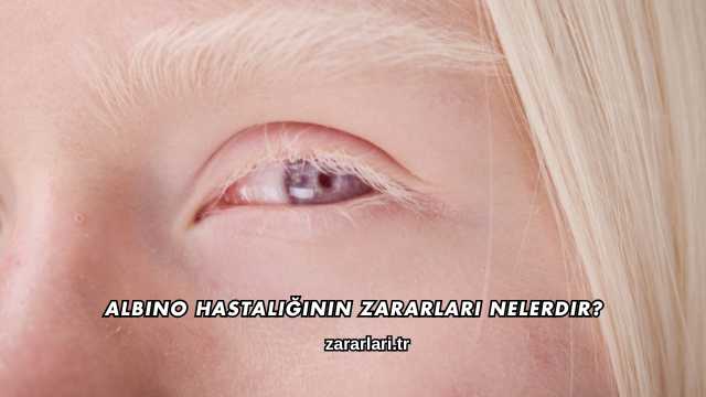 Albino Hastalığının Zararları Nelerdir?