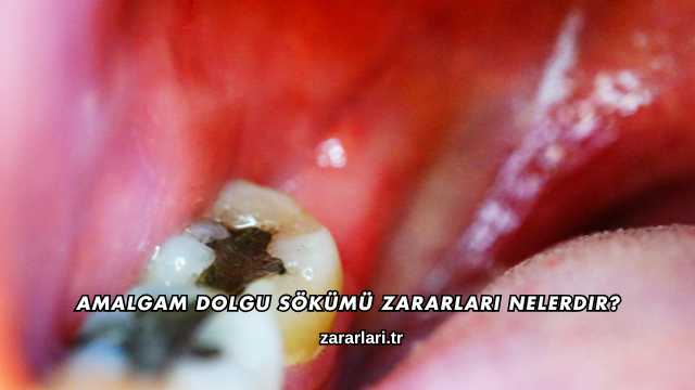 Amalgam Dolgu Sökümü Zararları Nelerdir?
