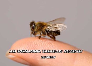 Arı Sokmasının Zararları Nelerdir?