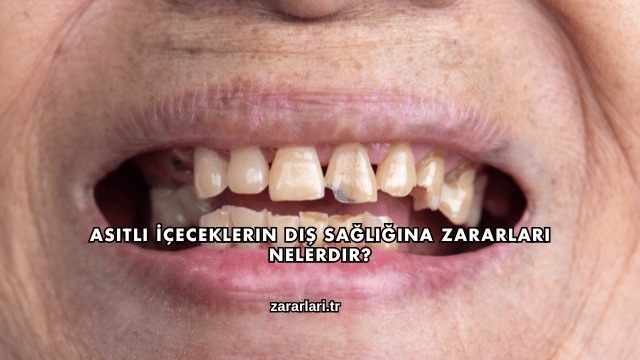 Asitli İçeceklerin Diş Sağlığına Zararları Nelerdir?