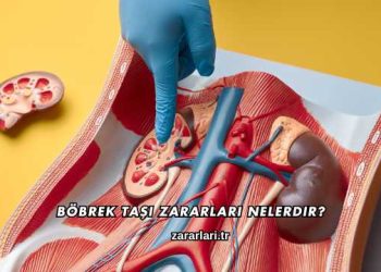 Böbrek Taşı Zararları Nelerdir?