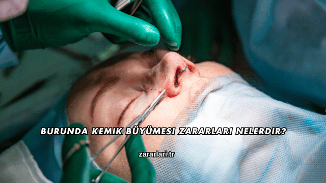 Burunda Kemik Büyümesi Zararları Nelerdir?