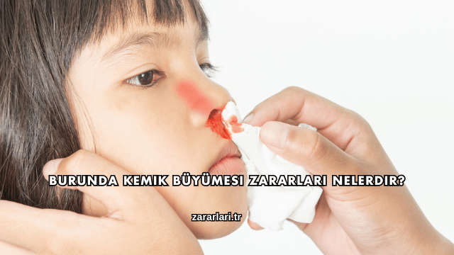 Burunda Kemik Büyümesi Zararları Nelerdir?