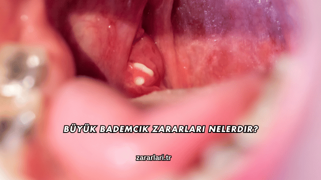 Büyük Bademcik Zararları Nelerdir?