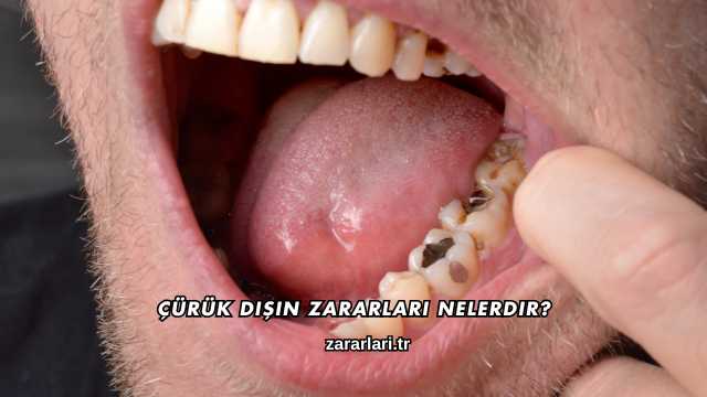 Çürük Dişin Zararları Nelerdir?