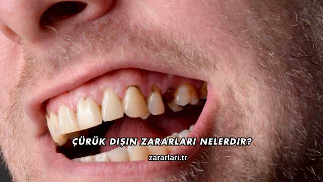 Çürük Dişin Zararları Nelerdir?