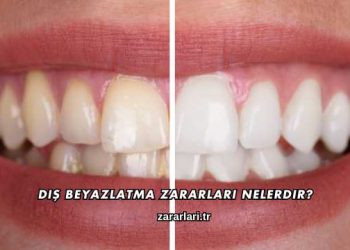 Diş Beyazlatma Zararları Nelerdir?