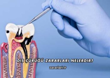 Diş Çürüğü Zararları Nelerdir?