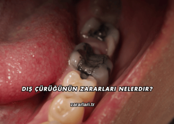 Diş Çürüğünün Zararları Nelerdir?