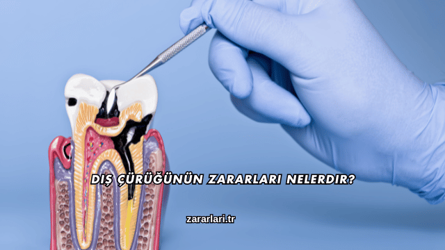 Diş Çürüğünün Zararları Nelerdir?