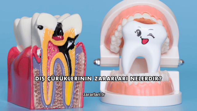 Diş Çürüklerinin Zararları Nelerdir?