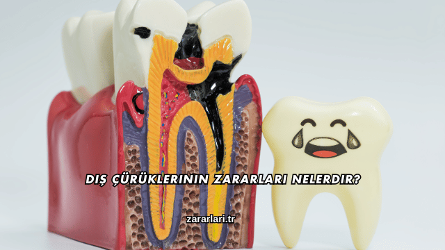 Diş Çürüklerinin Zararları Nelerdir?