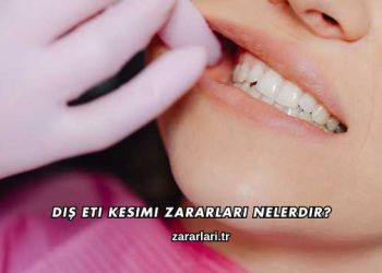 Diş Eti Kesimi Zararları Nelerdir?