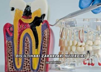 Diş İltihabı Zararları Nelerdir?