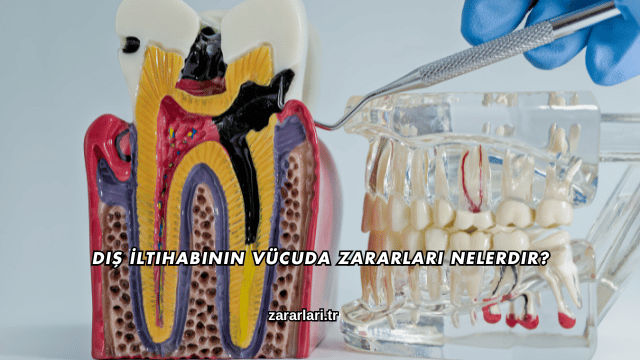 Diş İltihabının Vücuda Zararları Nelerdir?