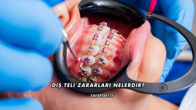 Diş Teli Zararları Nelerdir?