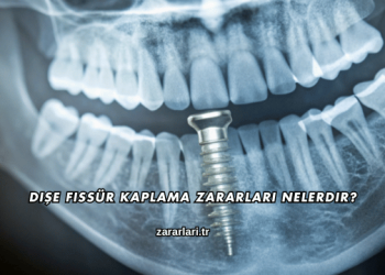 Dişe Fissür Kaplama Zararları Nelerdir?