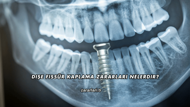 Dişe Fissür Kaplama Zararları Nelerdir?