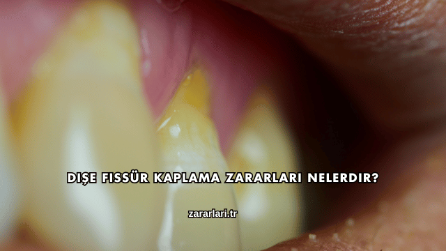 Dişe Fissür Kaplama Zararları Nelerdir?