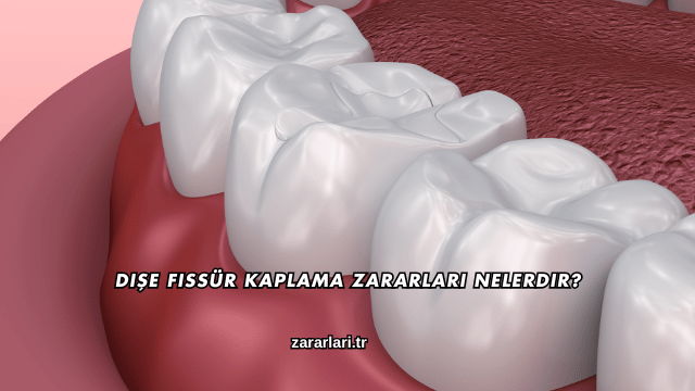 Dişe Fissür Kaplama Zararları Nelerdir?