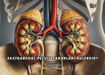 Ekstrarenal Pelvis Zararları Nelerdir?