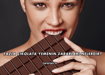 Fazla Çikolata Yemenin Zararları Nelerdir?