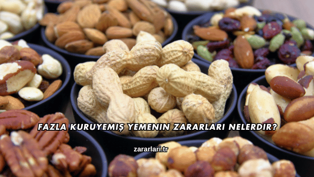 Fazla Kuruyemiş Yemenin Zararları Nelerdir?