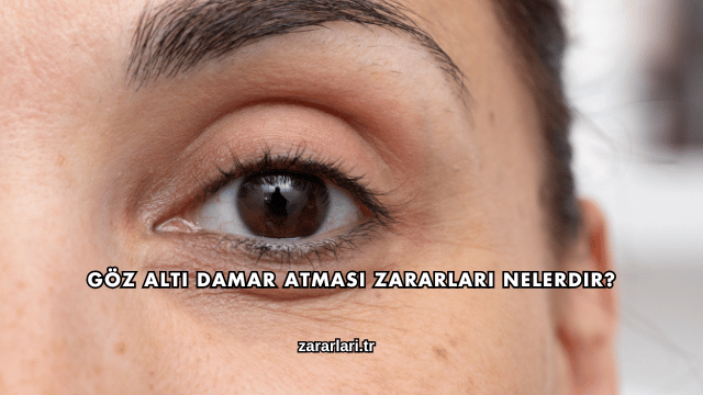 Göz Altı Damar Atması Zararları Nelerdir?