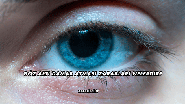 Göz Altı Damar Atması Zararları Nelerdir?
