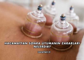 Hacamattan Sonra Uyumanın Zararları Nelerdir?