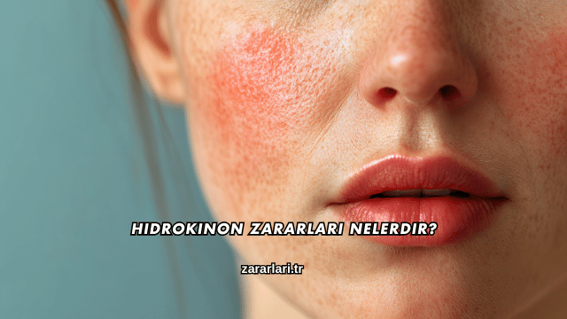 Hidrokinon Zararları Nelerdir?