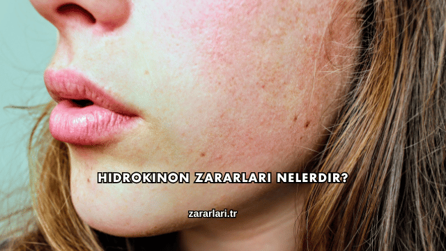 Hidrokinon Zararları Nelerdir?
