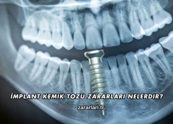 İmplant Kemik Tozu Zararları Nelerdir?