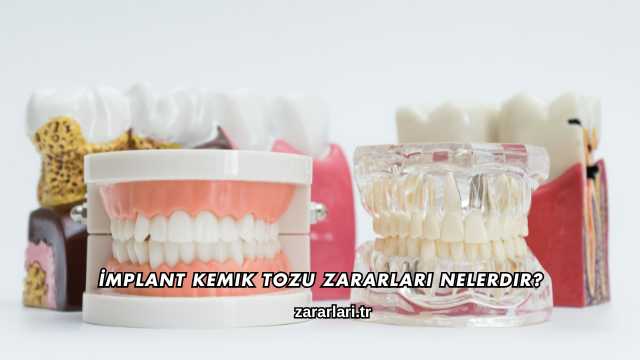 İmplant Kemik Tozu Zararları Nelerdir?