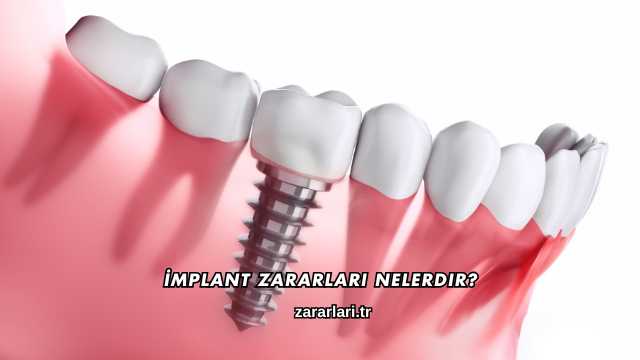 İmplant Zararları Nelerdir?