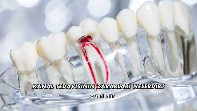 Kanal Tedavisinin Zararları Nelerdir?