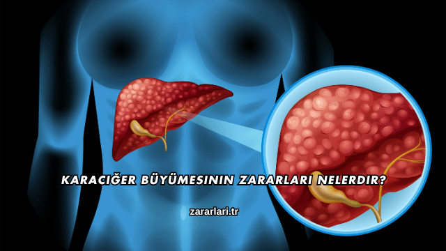 Karaciğer Büyümesinin Zararları Nelerdir?