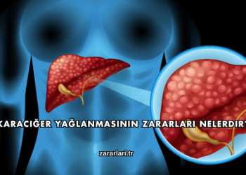 Karaciğer Yağlanmasının Zararları Nelerdir?