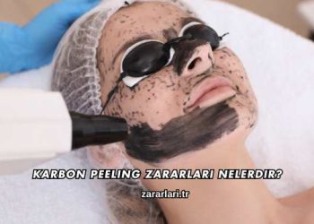 Karbon Peeling Zararları Nelerdir?