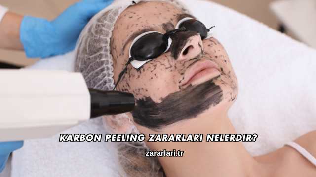 Karbon Peeling Zararları Nelerdir?