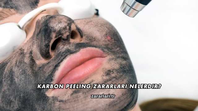 Karbon Peeling Zararları Nelerdir?