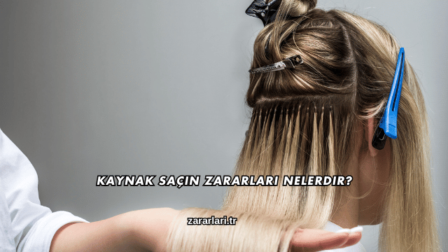 Kaynak Saçın Zararları Nelerdir?