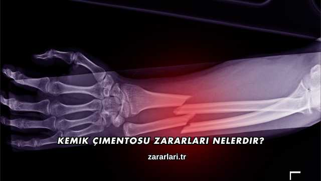 Kemik Çimentosu Zararları Nelerdir?