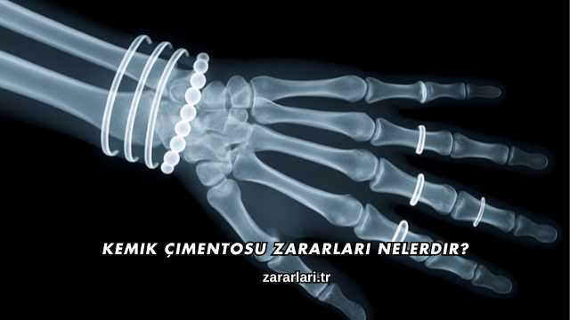 Kemik Çimentosu Zararları Nelerdir?