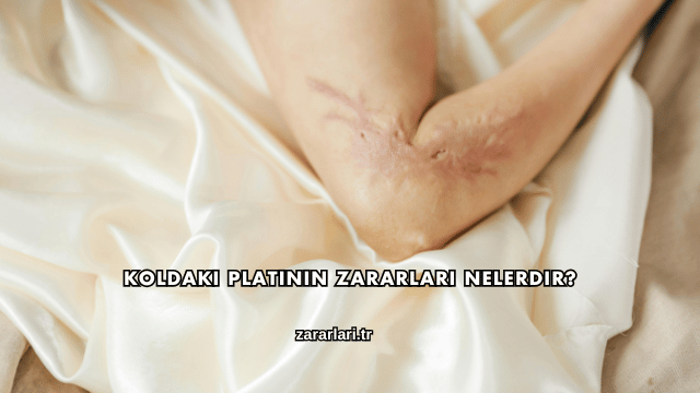 Koldaki Platinin Zararları Nelerdir?