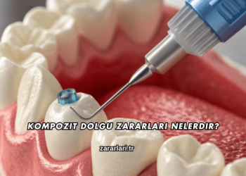 Kompozit Dolgu Zararları Nelerdir?